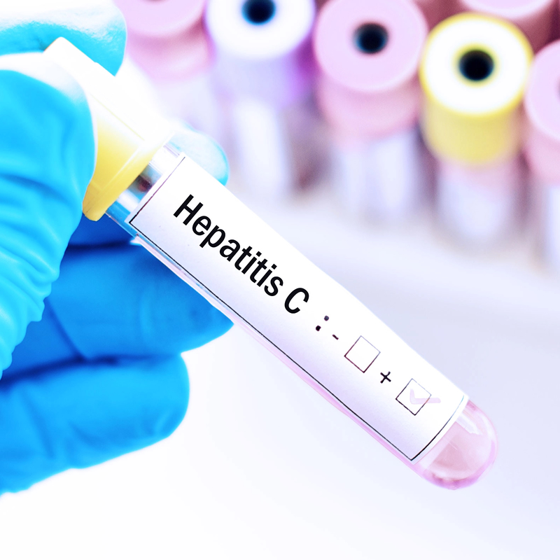 Nuevo avance contra la hepatitis C para mejorar la esperanza de vida
